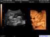 ecograf&iacute;a en 4D Karlo Iv&aacute;n con 29 semanas de gestaci&oacute;n
